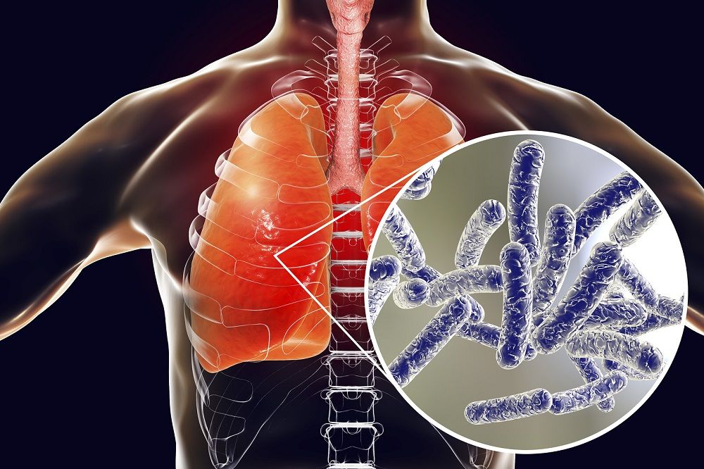 Rentokil Initial da la bienvenida al nuevo Real Decreto que actualiza la normativa de Legionella en España
