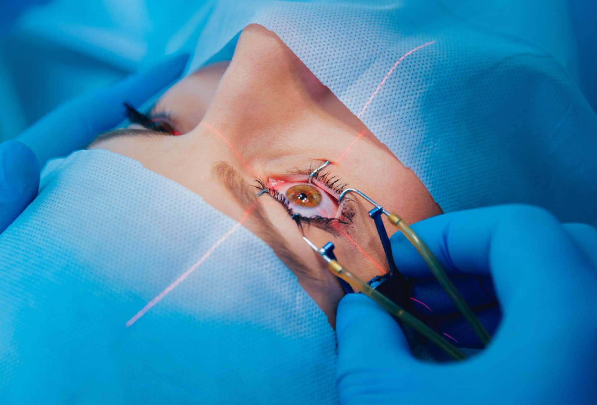 Cirugía de la catarata con lentes multifocales con el Departamento de Oftalmología del Hospital Universitario Dexeus