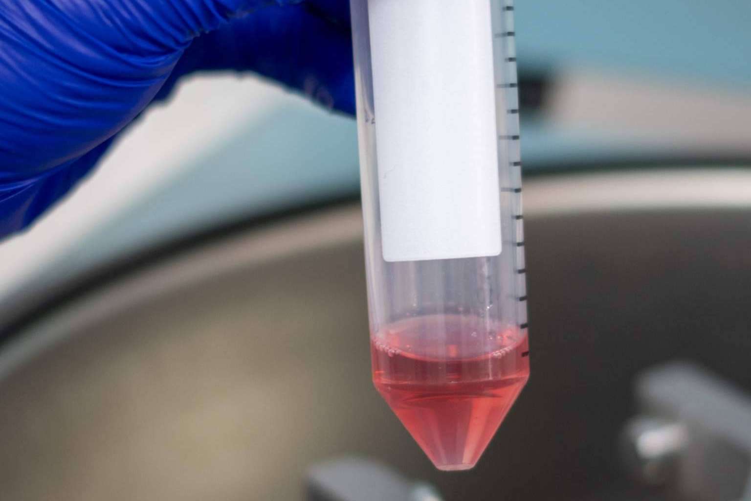 Oncovix y las últimas innovaciones en Citoreducción para el tratamiento del cáncer