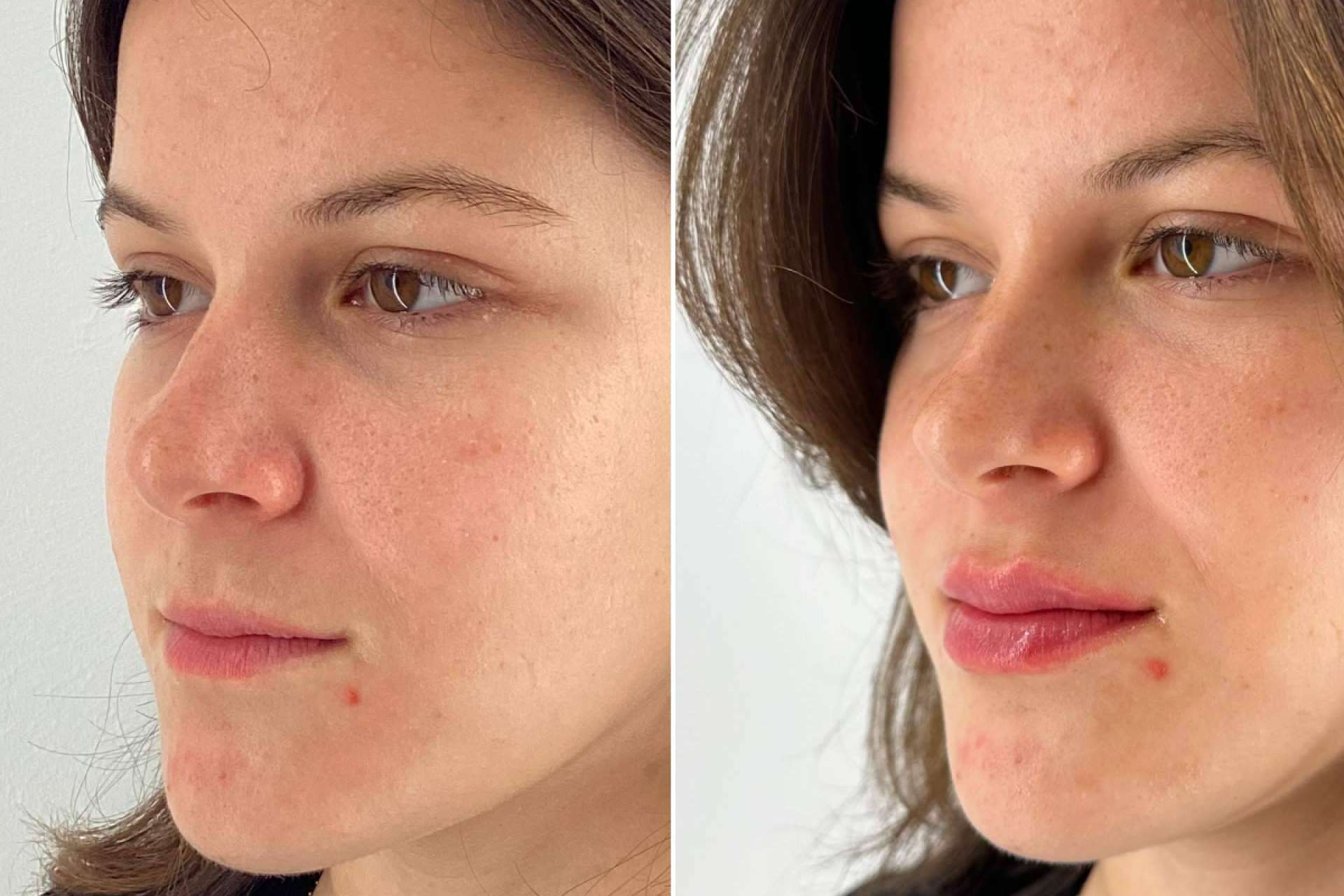 Glow Lips de Holaglow, la nueva referencia en armonización labial sin artificios