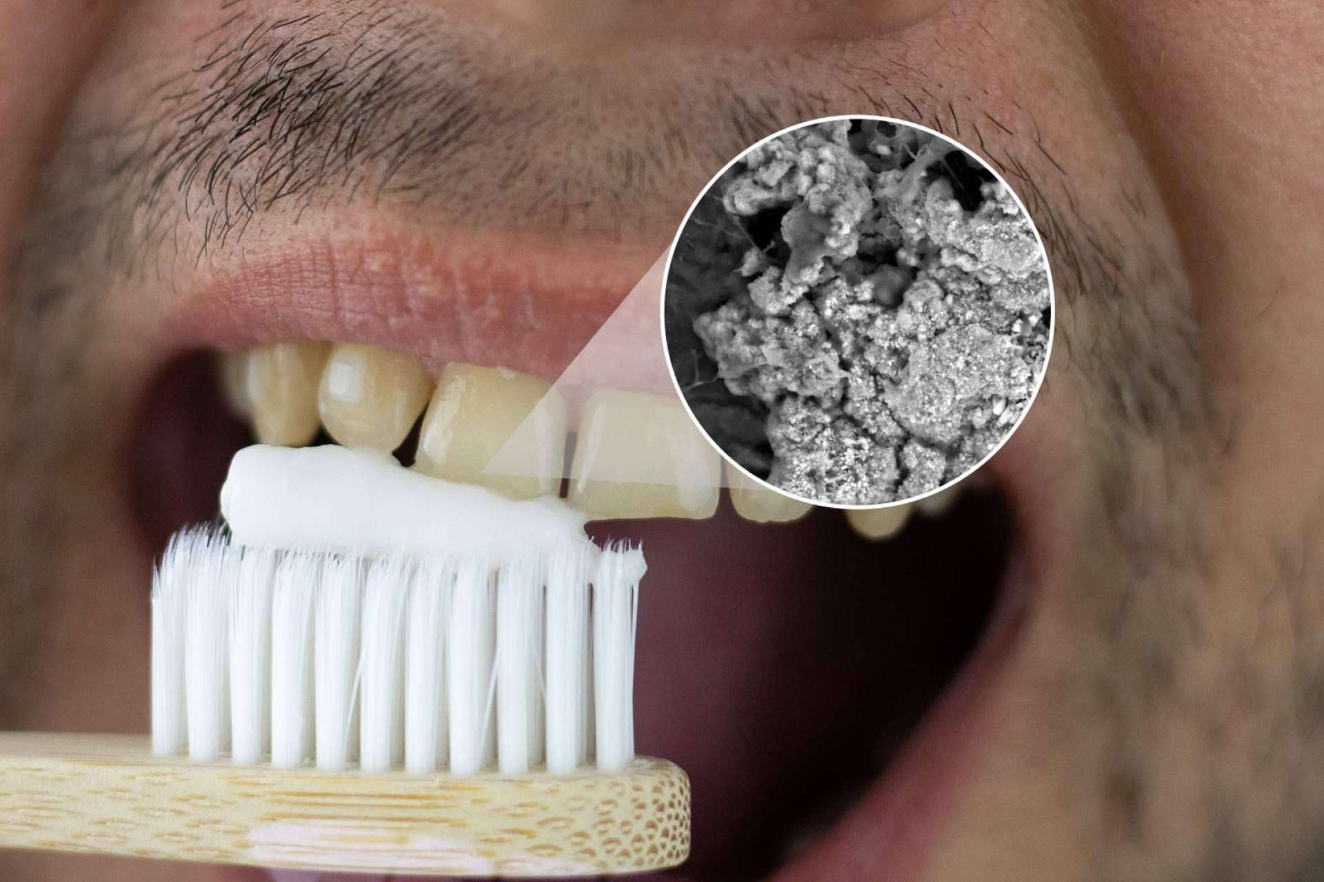 La revolución en el cuidado dental; Una pasta de dientes que regenera el esmalte y elimina manchas