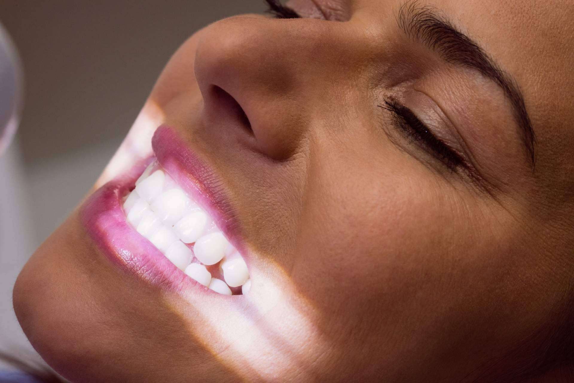 Clínica Calvo De Mora ofrece sesiones de blanqueamiento dental LED con resultados visibles desde la primera aplicación