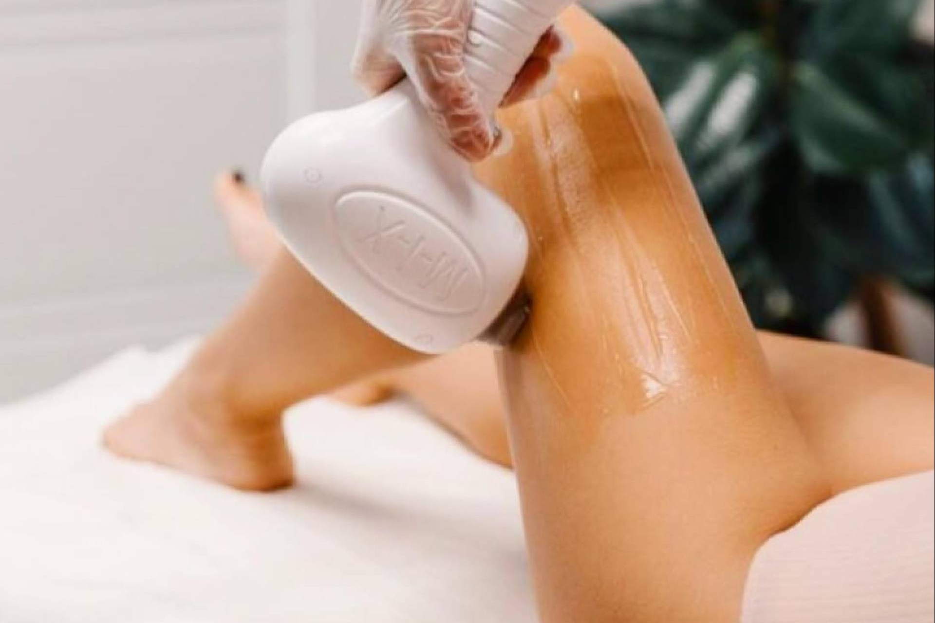 The Clinic apuesta por la innovación estética con Wonder y depilación láser cuerpo completo